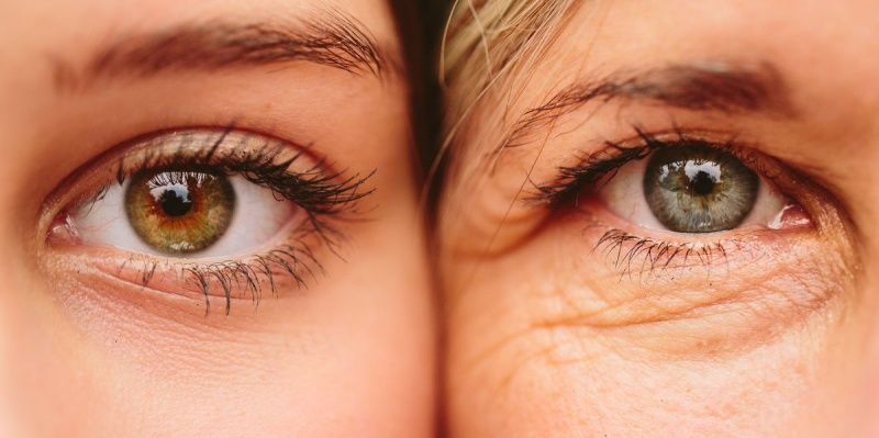 Mengatasi Keriput Mata: Produk dan Teknik Perawatan